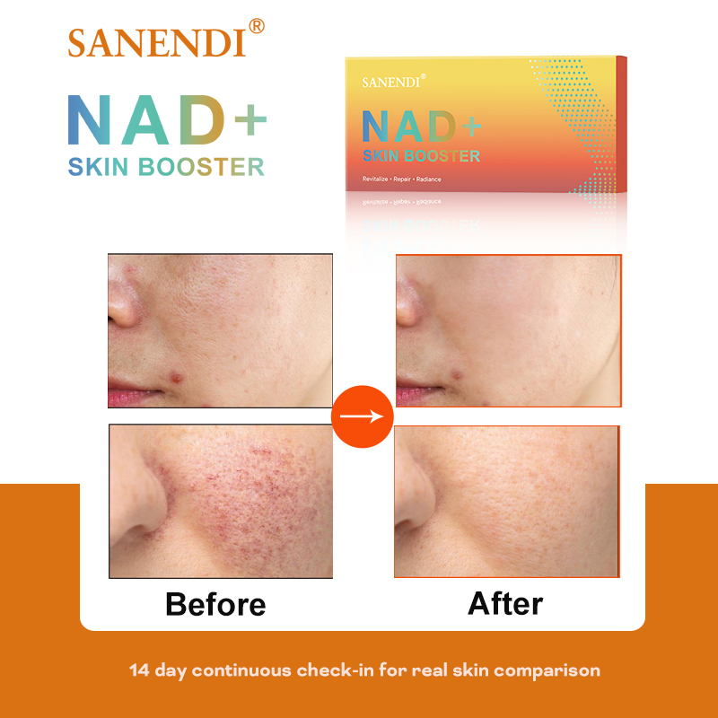 Sanendi NAD + Coreia Produto p - Korean Skincare Routine avaliação e preço